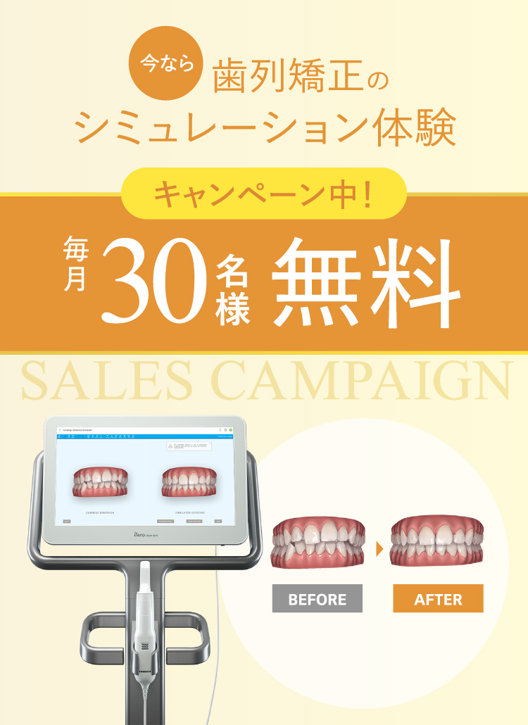 歯科矯正のシュミレーション体験キャンペーン中！